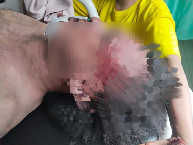 jurnalis media online Nico Saragih (38), ditemukan tidak bernyawa di kamar mandi kosnya pada Jumat, 5 September 2025 di Jalan PWS, Medan Petisah.